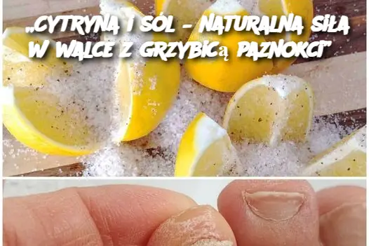 „Cytryna i sól – naturalna siła w walce z grzybicą paznokci”